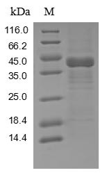 TGF-beta-activated kinase 1 and MAP3K7-binding protein 2 (TAB2), partial, human, recombinant