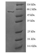 Steroid 21-hydroxylase (CYP21A2), human, recombinant