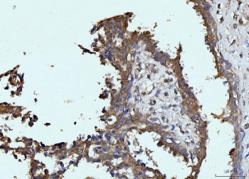 Anti-Glutaminase / GLS