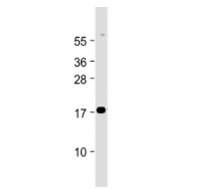 Anti-Chemerin / RARRES2