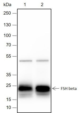 Anti-Recombinant FSH beta, clone A407