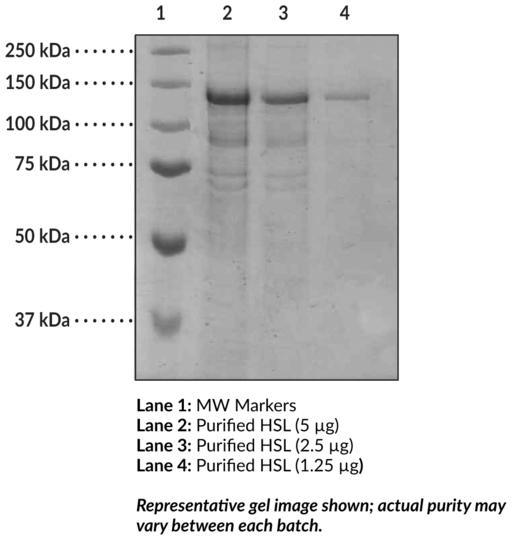 Hormone-Sensitive Lipase (human, recombinant)