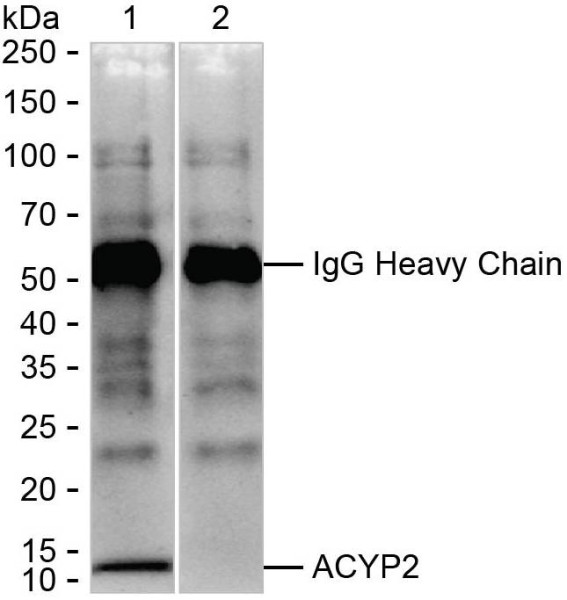 Anti-ACYP2