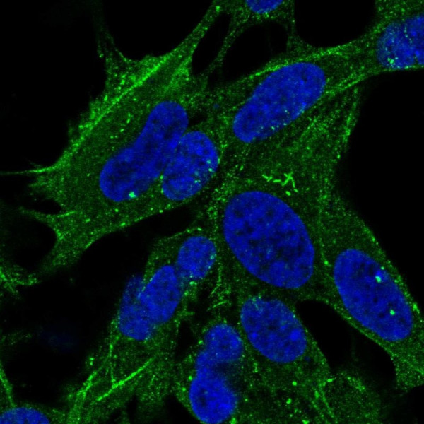 Anti-SYNPO2