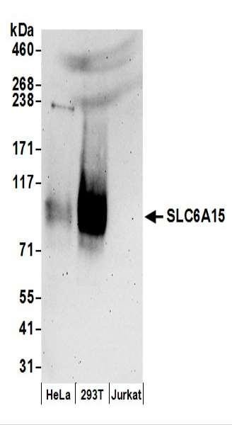 Anti-SLC6A15