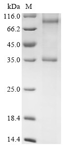 Chemerin-like receptor 2 (Cmklr2), rat, recombinant