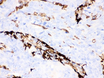 Anti-Gelsolin, clone GEL-42