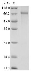 Pyruvate dehydrogenase E1 component subunit alpha, somatic form, mitochondrial (PDHA1),partial, huma