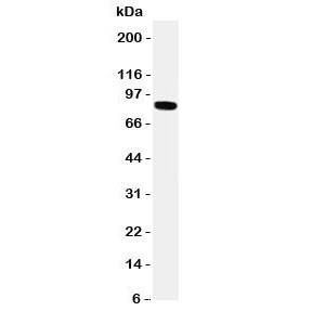 Anti-TRPV2 (VRL1)