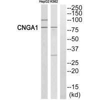 Anti-CNGA1