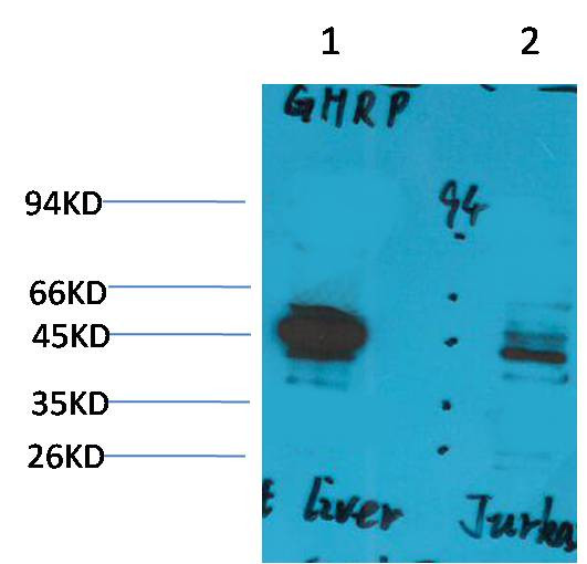 Anti-Ghrelin Receptor