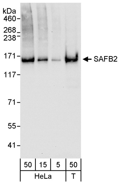 Anti-SAFB2