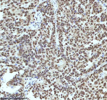 Anti-IRF2BP1 / Interferon regulatory factor 2-binding protein 1