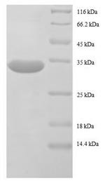 50S ribosomal protein L32 (rpmF), Escherichia coli, recombinant