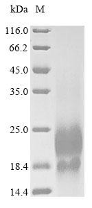 Lymphocyte antigen 6 complex locus protein G6d (LY6G6D), partial, human, recombinant
