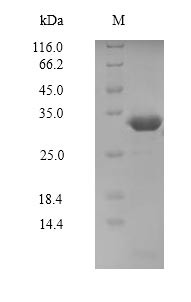 Serine/threonine-protein kinase PAK 5 (PAK5), partial, human, recombinant