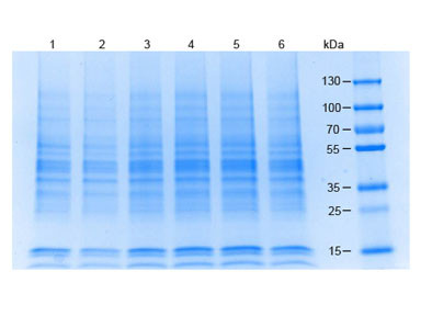 MCF-7 Whole Cell Lysate, 1.0 mg/ml by BCA assay, in 1X SDS-PAGE Sample Buffer