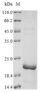 Mucin-5B (MUC5B), partial, human, recombinant
