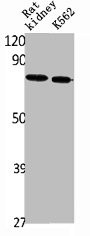 Anti-SLC34A2