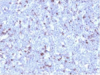 Anti-CD43 (T-Cell Marker) Recombinant Mouse Monoclonal Antibody (clone:rSPN/1094)