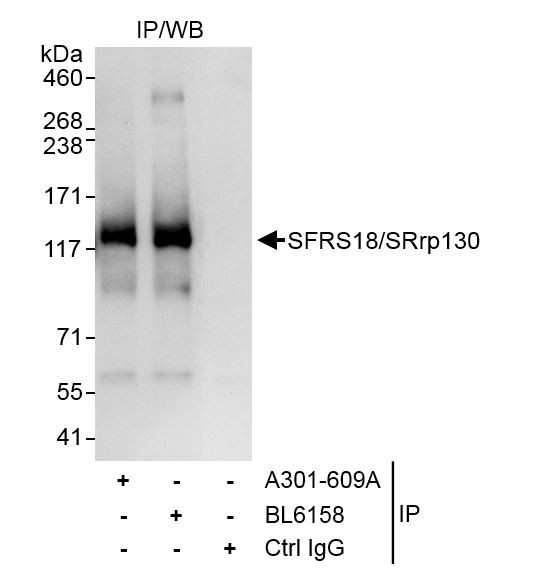 Anti-SFRS18/SRrp130