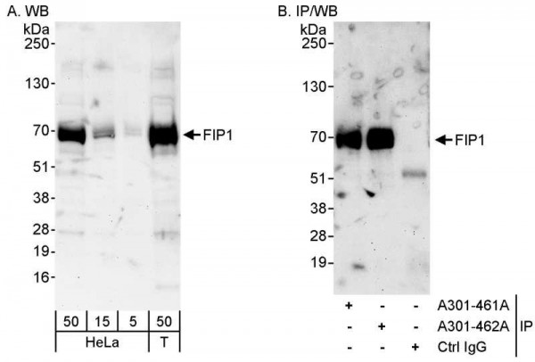 Anti-FIP1