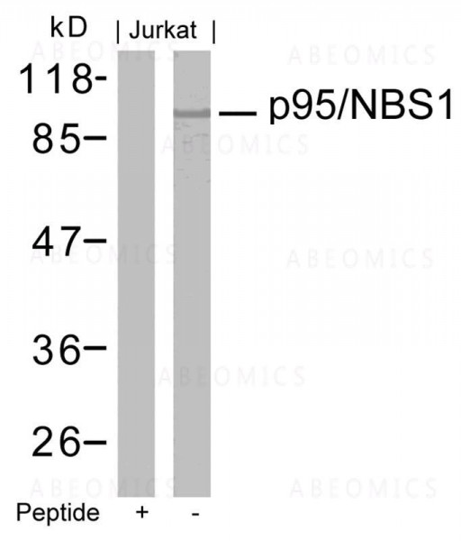 Anti-p95/NBS1 (Ab-343)