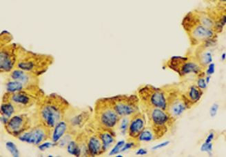Anti-WNT5B