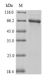 Vitamin D-binding protein (Gc), mouse, recombinant
