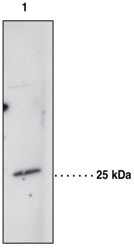Anti-Prostaglandin D Synthase