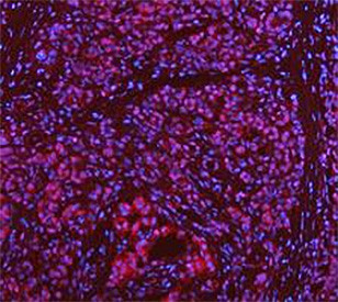 Anti-DEAD box protein 1 / DDX1