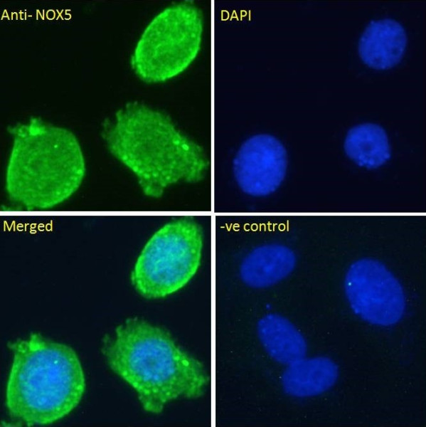Anti-NOX5