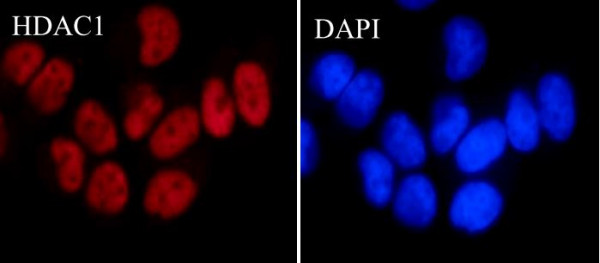Anti-HDAC1, clone SQab1867