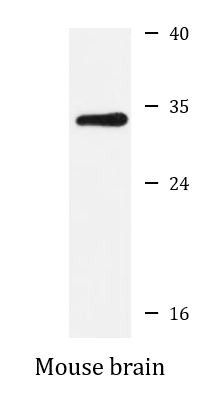 Anti-SLC25A14