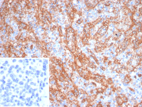 Anti-CD36 (Platelet &amp; Microvessel Marker), clone CD36/7216