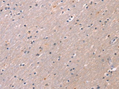 Anti-KCNK3