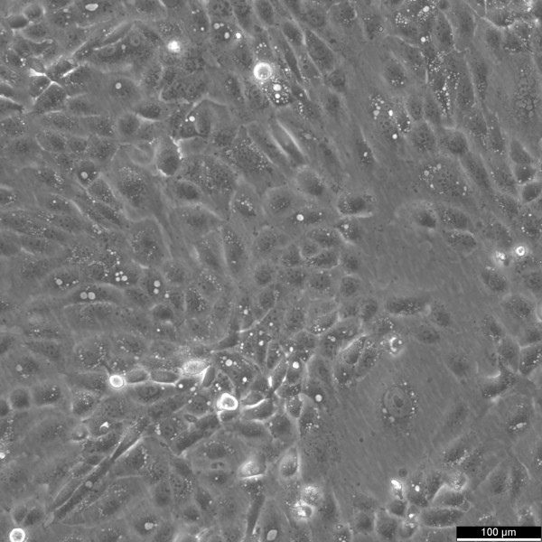 CFPAC-1 Cells