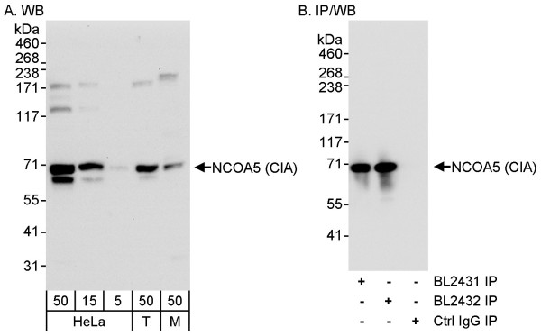 Anti-NCOA5/CIA
