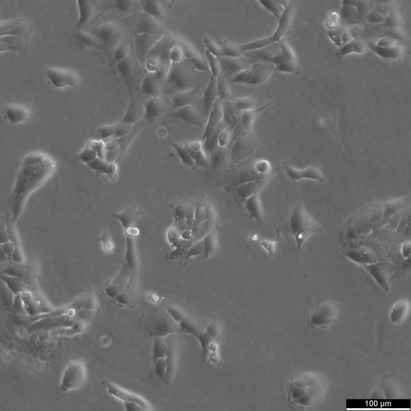 143B Cells