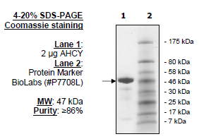 AHCY, recombinant S.solfataricus protein, N-terminal His-tag