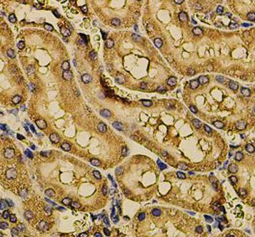 Anti-FDX1 / Ferredoxin