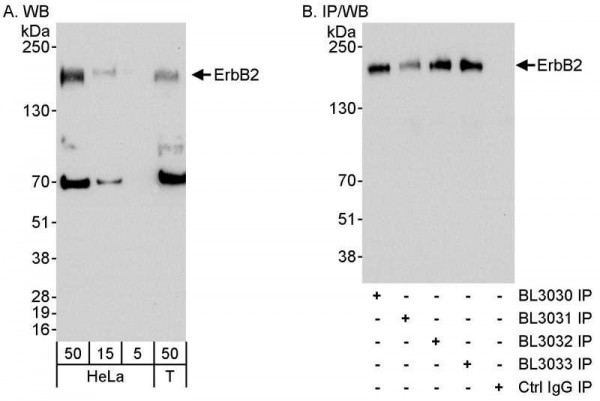 Anti-ErbB2