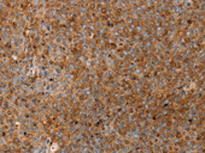 Anti-SERPINB2
