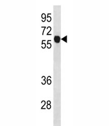 Anti-Cyclin B1 (CCNB1)