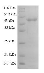 A disintegrin and metalloproteinase with thrombospondin motifs 7 (ADAMTS7), partial, human, recombin