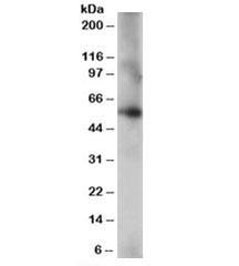 Anti-CORO1C