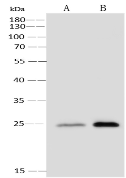 Anti-G-CSF Monoclonal Antibody