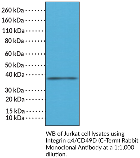 Anti-Integrin alpha4/CD49D (C-Term) Rabbit Monoclonal Antibody (Clone RM268)