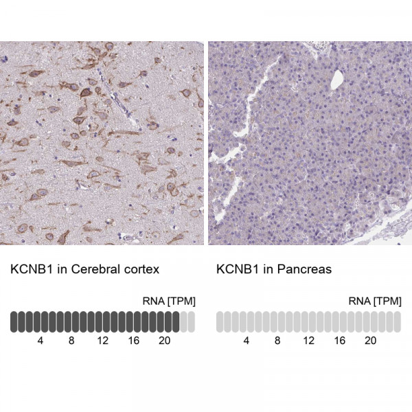 Anti-KCNB1