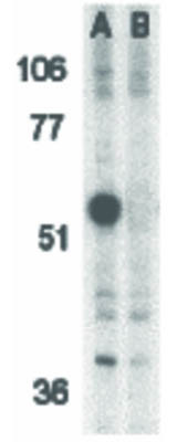 Anti-Caspase-12